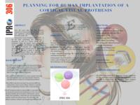 Planning for Human Implantat ion of a Cor t ical Visual Prothesis (Semester Unknown) IPRO 306: Planning for Human Implantation of a Cortical Visual Prothesis IPRO 306 Poster F08